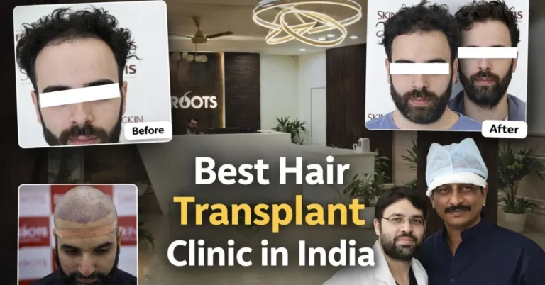 Best hair transplant clinic in india